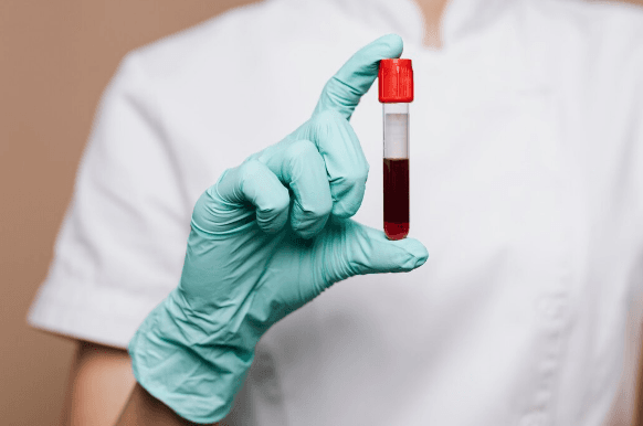 blood cleaning, blood cleanup, how do I clean up blood, best way to clean up blood