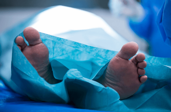 crime scene body, human remains at crime scene, homicide crime scene, body recovery