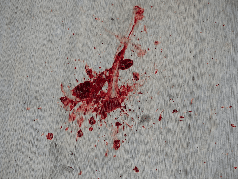 dead body cleanup